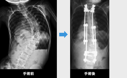 脊椎 脊髄班 整形外科教室 慶應義塾大学医学部整形外科学教室